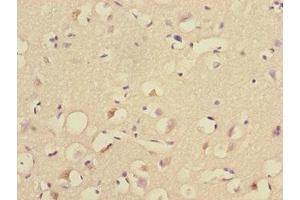 Immunohistochemistry of paraffin-embedded human brain tissue using ABIN7174506 at dilution of 1:100 (UBE2Z antibody  (AA 115-354))