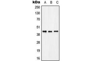 Western blot analysis of KCNAB3 expression in THP1 (A), rat brain (B), rat kidney (C) whole cell lysates. (KCNAB3 antibody  (C-Term))