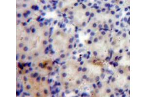 Used in DAB staining on fromalin fixed paraffin-embedded kidney tissue (ANGPTL4 antibody  (AA 182-394))