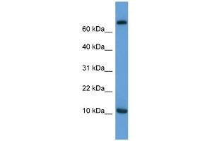 WB Suggested Anti-Ccl20 Antibody Titration:  0. (CCL20 antibody  (C-Term))