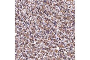 IHC analysis of TOMM34 using anti-TOMM34 antibody (ABIN7599253). (TOMM34 antibody  (AA 1-309))