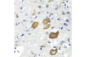 Immunohistochemistry of paraffin-embedded rat brain using IFNL1 antibody at dilution of 1:100 (40x lens). (IL29 antibody)