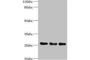 Western blot All lanes: TFAM antibody at 8 μg/mL Lane 1: Jurkat whole cell lysate Lane 2: MCF-7 whole cell lysate Lane 3: A431 whole cell lysate Secondary Goat polyclonal to rabbit IgG at 1/10000 dilution Predicted band size: 30, 26 kDa Observed band size: 26 kDa (TFAM antibody  (AA 43-246))