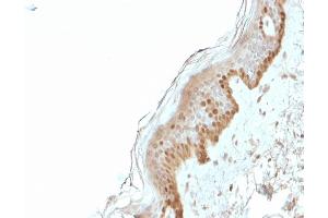 Immunohistochemistry (IHC) image for anti-S100 Calcium Binding Protein A2 (S100A2) antibody (ABIN6940540)