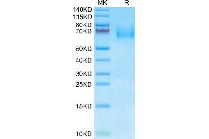 IL23R Protein (AA 24-355) (His tag)