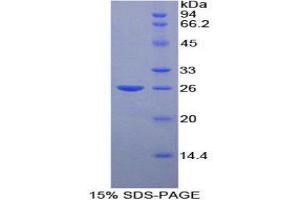 SDS-PAGE (SDS) image for Fibulin 2 (FBLN2) (AA 896-1106) protein (His tag) (ABIN2121063)