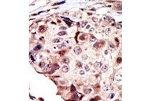 Image no. 1 for anti-RYK Receptor-Like Tyrosine Kinase (RYK) (AA 150-200) antibody (ABIN359937) (RYK antibody  (AA 150-200))