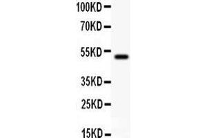 Anti- gamma Catenin Picoband antibody, Western blotting All lanes: Anti gamma Catenin at 0. (JUP antibody  (AA 556-745))