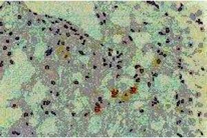 Immunohistochemistry (IHC) image for anti-Hepatitis C Virus Core Protein (HCV C) (AA 13-124), (AA 369-704) antibody (Biotin) (ABIN2451996)