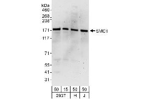 Western Blotting (WB) image for anti-Structural Maintenance of Chromosomes 1A (SMC1A) (AA 1183-1233) antibody (ABIN7454968)