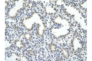 Rabbit Anti-HNRPAB antibody         Paraffin Embedded Tissue:  Human Lung    cell Cellular Data:  alveolar cell    Antibody Concentration:  4. (HNRNPAB antibody  (C-Term))