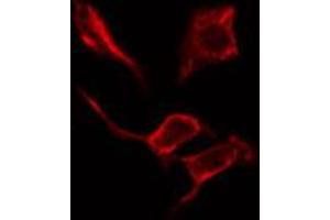 ABIN6274622 staining Hela cells by IF/ICC.