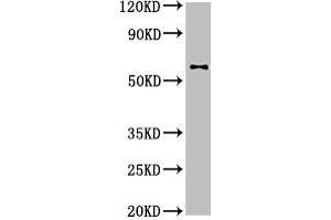 Western Blot Positive WB detected in: U87 whole cell lysate All lanes: DPYSL2 antibody at 4 μg/mL Secondary Goat polyclonal to rabbit IgG at 1/50000 dilution Predicted band size: 63, 59 kDa Observed band size: 63 kDa (DPYSL2 antibody  (AA 1-572))