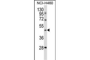 TLE6 Antibody (N-term ) (ABIN657408 and ABIN2846448) western blot analysis in NCI- cell line lysates (35 μg/lane). (TLE6 antibody  (N-Term))