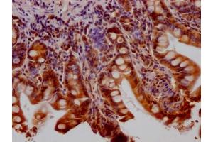 IHC image of ABIN7127558 diluted at 1:100 and staining in paraffin-embedded human small intestine tissue performed on a Leica BondTM system. (Recombinant Huntingtin antibody)