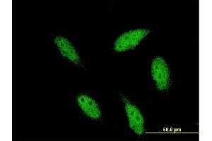 Immunofluorescence of monoclonal antibody to TBR1 on HeLa cell.
