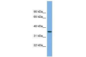 WB Suggested Anti-PRSS22 Antibody Titration: 0. (PRSS22 antibody  (N-Term))