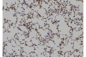 ABIN6269100 at 1/100 staining Mouse lung tissue by IHC-P. (FYN antibody  (C-Term))