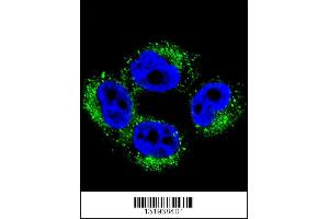 Confocal immunofluorescent analysis of AP1M1 Antibody with A375 cell followed by Alexa Fluor 488-conjugated goat anti-rabbit lgG (green). (AP1M1 antibody  (AA 199-227))