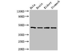 Western Blot Positive WB detected in: Hela whole cell lysate, Mouse brain tissue, Mouse kidney tissue, Mouse stomach tissue All lanes: NOB1 antibody at 1. (NOB1 antibody  (AA 103-229))
