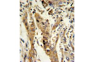 Immunohistochemistry (IHC) image for anti-Glutathione S-Transferase mu 1 (GSTM1) antibody (ABIN3002864) (GSTM1 antibody)
