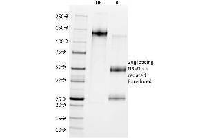 SDS-PAGE Analysis Purified MDM2 Mouse Monoclonal Antibody (SMP14). (MDM2 antibody  (AA 154-167))