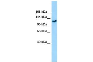 WB Suggested Anti-GMIP Antibody Titration: 1. (GMIP antibody  (C-Term))