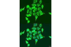 Immunofluorescence analysis of U2OS cells using RASGRP3 antibody. (RASGRP3 antibody  (AA 540-689))