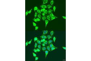 Immunofluorescence analysis of U2OS cells using RASGRP3 antibody. (RASGRP3 antibody  (AA 540-689))
