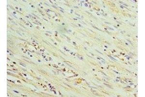 Immunohistochemistry of paraffin-embedded human epityphlon tissue using ABIN7172096 at dilution of 1:100 (THBS3 antibody  (AA 787-956))