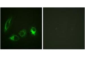 Immunofluorescence analysis of HeLa cells, using IRS-1 (Phospho-Ser323) Antibody. (IRS1 antibody  (pSer323))