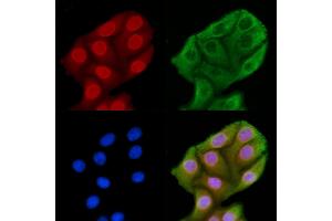 ABIN6262710 and ABIN6269260 staining HepG2 cells by IF/ICC. (JNK antibody  (Internal Region))