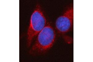 IF analysis of SYT16 using anti-SYT16 antibody (ABIN7599425). (SYT16 antibody  (AA 1-474))