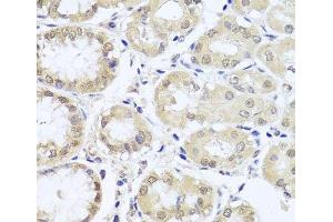 Immunohistochemistry of paraffin-embedded Human stomach using CGB7 Polyclonal Antibody at dilution of 1:100 (40x lens). (CGB7 antibody)