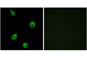 Immunofluorescence analysis of HuvEc cells, using HTR5B Antibody. (HTR5B antibody  (AA 280-329))