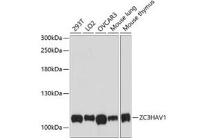 Western blot analysis of extracts of various cell lines, using ZC3H antibody (ABIN6133131, ABIN6150402, ABIN6150403 and ABIN6224936) at 1:3000 dilution. (ZC3HAV1 antibody  (AA 150-400))