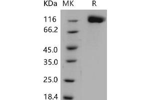 Oncostatin M Receptor (OSMR) protein (His tag)