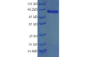 SDS-PAGE (SDS) image for Syntaxin 6 (STX6) (AA 5-234), (partial) protein (GST tag) (ABIN4974692)