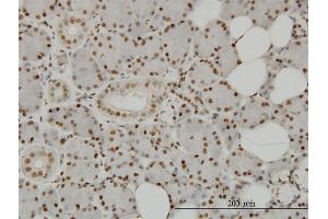 Immunoperoxidase of monoclonal antibody to SPSB2 on formalin-fixed paraffin-embedded human salivary gland. (SPSB2 antibody  (AA 1-90))