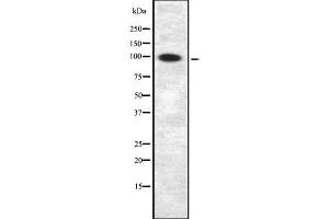 Western blot analysis of APBB1IP using COLO205 whole  lysates. (Amyloid beta (A4) Precursor Protein-Binding, Family B, Member 1 Interacting Protein (APBB1IP) (Internal Region) antibody)
