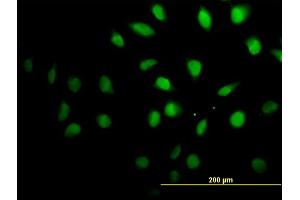 Immunofluorescence of monoclonal antibody to SETX on HeLa cell. (Senataxin (SETX) (AA 2579-2676) antibody)