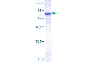 PSMC4 Protein (AA 1-418) (GST tag)