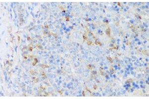 Immunohistochemistry of paraffin-embedded Mouse spleen using CRACR2A Polyclonal Antibody at dilution of 1:150 (40x lens). (EFCAB4B antibody)