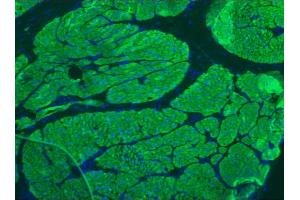 Image no. 1 for anti-Smoothelin (SMTN) antibody (ABIN335397) (Smoothelin antibody)