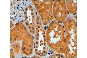 Immunohistochemistry (Paraffin-embedded Sections) (IHC (p)) image for anti-Tripartite Motif Containing 11 (TRIM11) (C-Term) antibody (ABIN1109331)