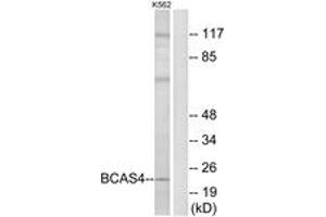 Western blot analysis of extracts from K562 cells, using BCAS4 Antibody. (BCAS4 antibody  (AA 31-80))