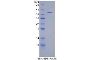 SDS-PAGE (SDS) image for Keratin 71 (KRT71) (AA 132-440) protein (His tag) (ABIN1080165)