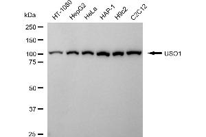Western blotting analysis using USO1 antibody (ABIN7800775).