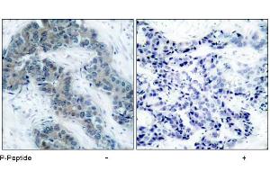 Image no. 1 for anti-Janus Kinase 2 (JAK2) (pTyr1007) antibody (ABIN196873) (JAK2 antibody  (pTyr1007))