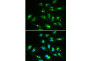 Immunofluorescence analysis of HepG2 cell using CD46 antibody. (CD46 antibody  (AA 40-320))